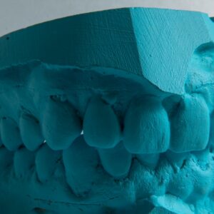 Photo Coral bleaching